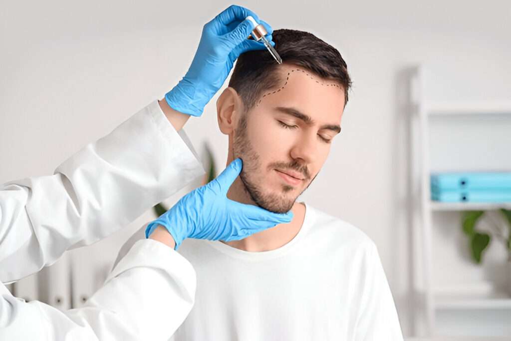 hair transplant London