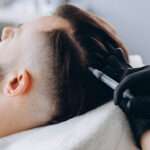 Hair Transplant