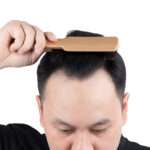 hair transplant UK