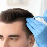 Hair Transplant