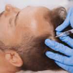 Hair Transplant