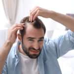 Hair Transplants