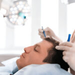 London hair transplant