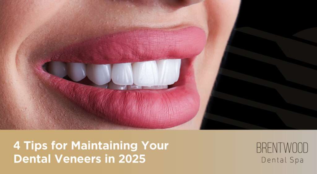 4 Tips for Maintaining Your Dental Veneers in 2025