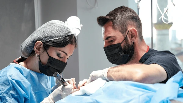 hair transplant