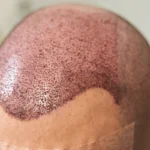 hair fibers for men