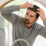 best age for hair transplant