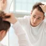 scalp Pigmentation